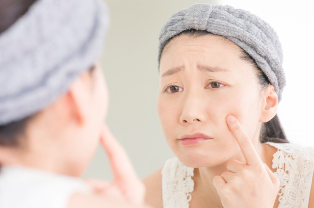 粉瘤とは？皮膚の下にできる良性腫瘍の正体 