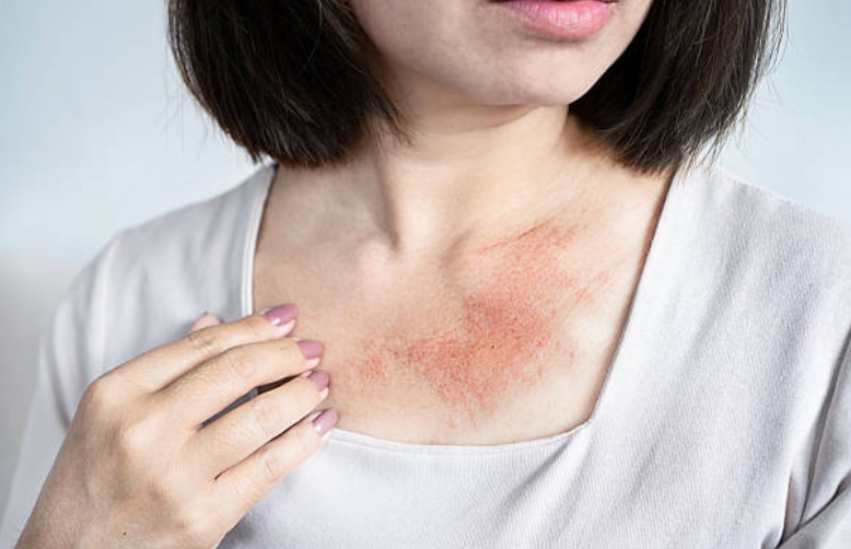 蕁麻疹が突然全身に！何科を受診すべき？原因・応急処置・治療を解説